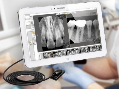 NEW RioSensor Intraoral Radiography System from Ray Medical