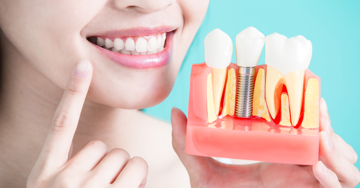 always-innovating-dental-depot-implantmed-feature