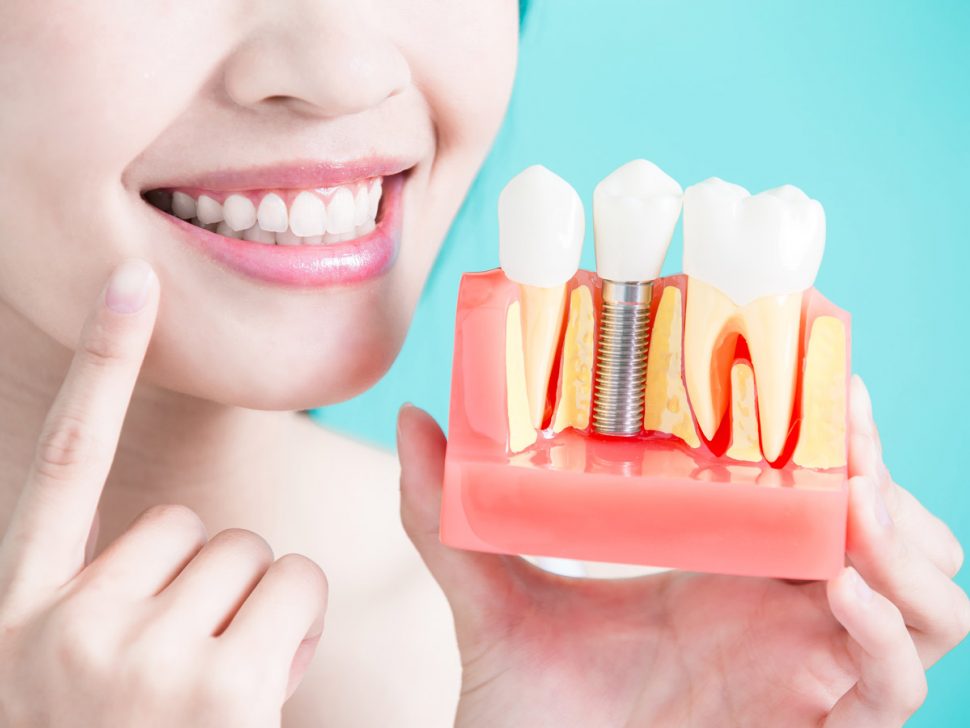 always-innovating-dental-depot-implantmed-thumbnail