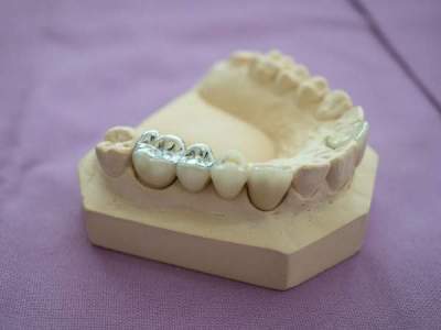 Why The Classic Amalgamator Should Still Be Used In Your Dental Clinic